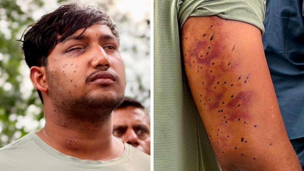 Forensic Experts Confirm Pellet Gun Use in Delhi Protest