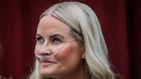 Norway’s Crown Princess Mette‑Marit Successfully Completes Lung Transplant